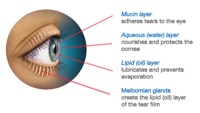 Meibomian Gland Dysfunction Eye Care Surgery Center